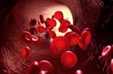 Maladie de Vaquez : la polyglobulie augmente le risque de thrombose